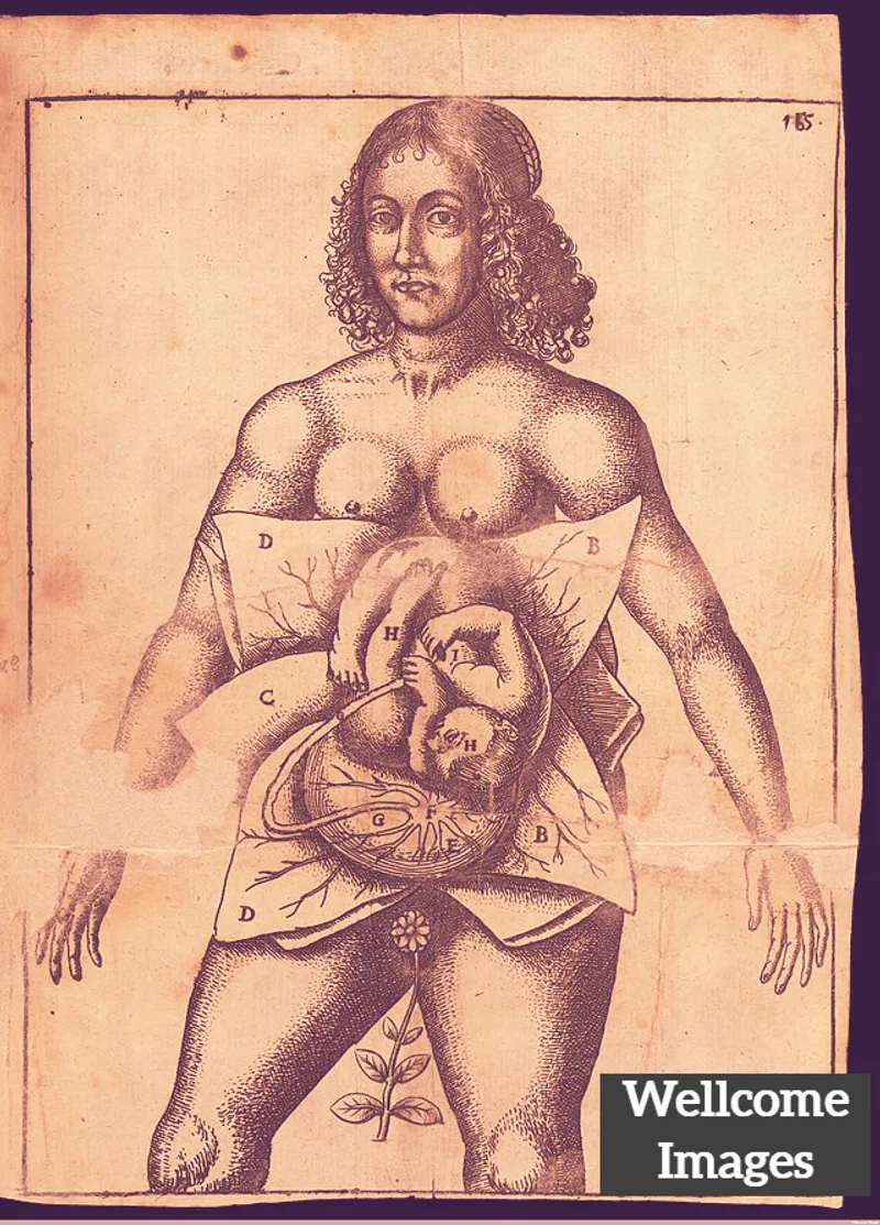 A 17th-century anatomical illustration showing a fetus in the womb. (Credit: Wellcome Collection)
