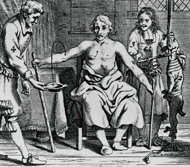 An engraving of a man receiving a blood transfusion from an animal, illustrating the experimental methods used in early transfusion history.