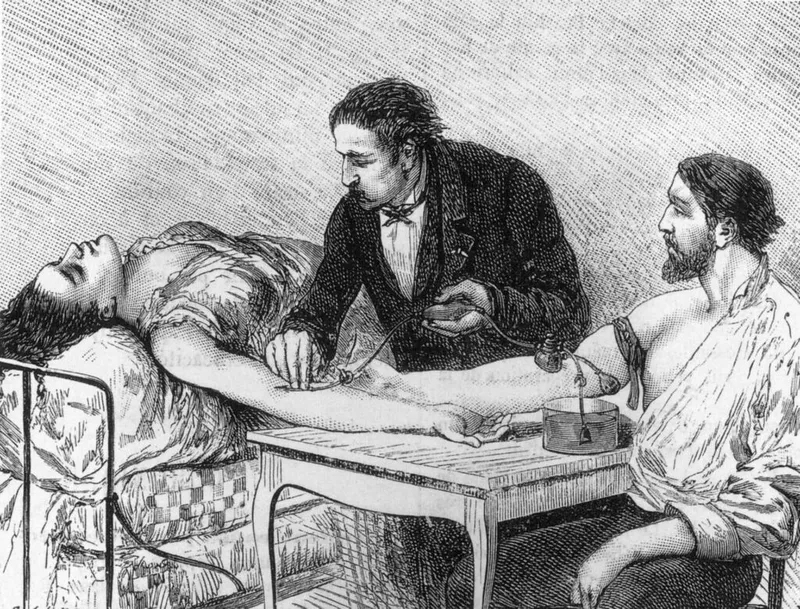 This image shows a direct blood transfusion procedure from one person to another.