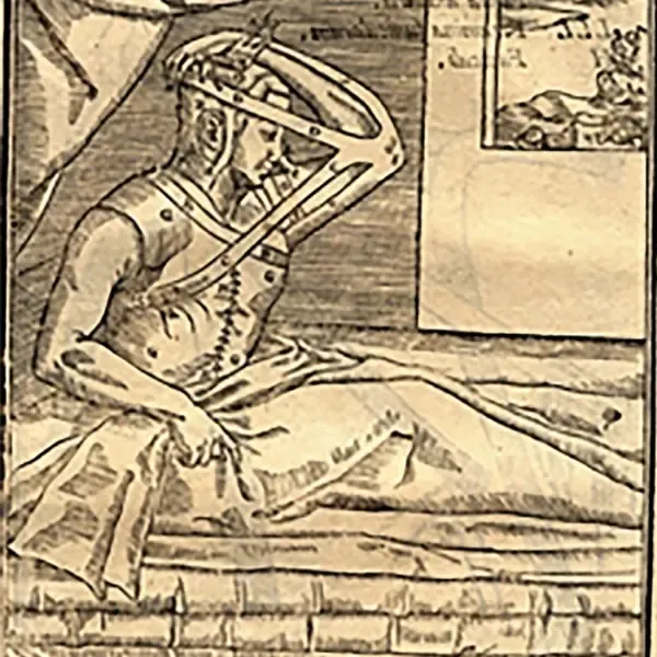 G. Tagliacozzi woodcut showing plastic surgery of the nose (1597). Credit: Wellcome Images