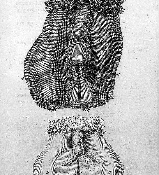 A Hermaphrodite’s sexual organs, in The anatomy of the humane body by William Cheselden (1750). Credit: Wellcome Library.