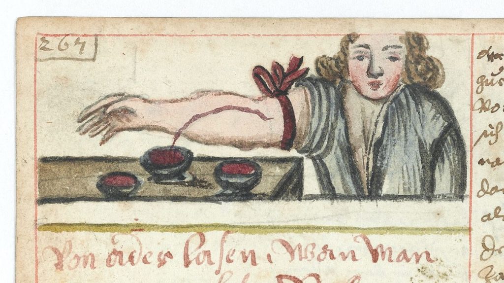 Illustration of bloodletting as a way of restoring health in a vernacular medical book (ca. 1675). (Wellcome Images)